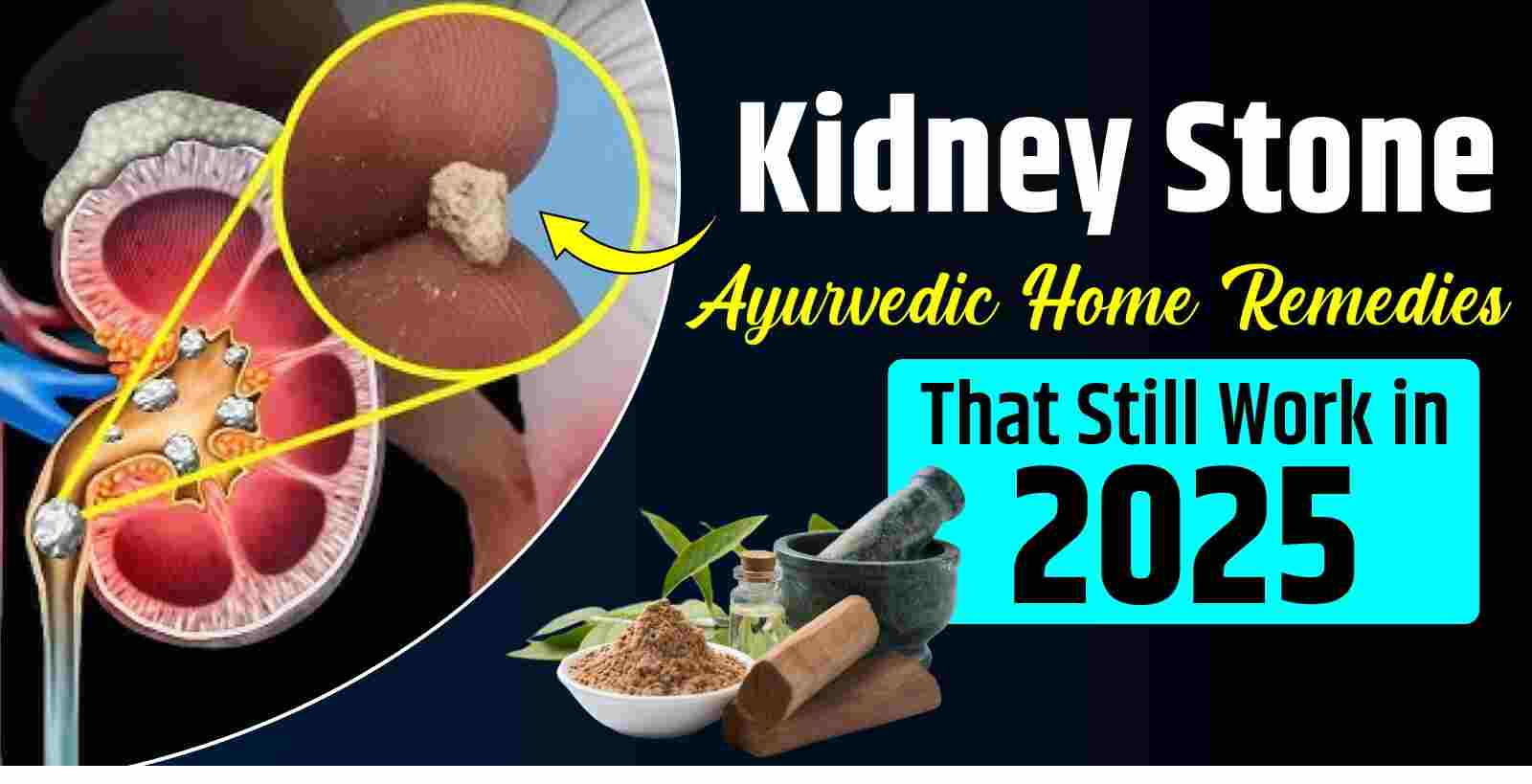 Kidney Stone Ayurvedic Home Remedies That Still Work in 2025